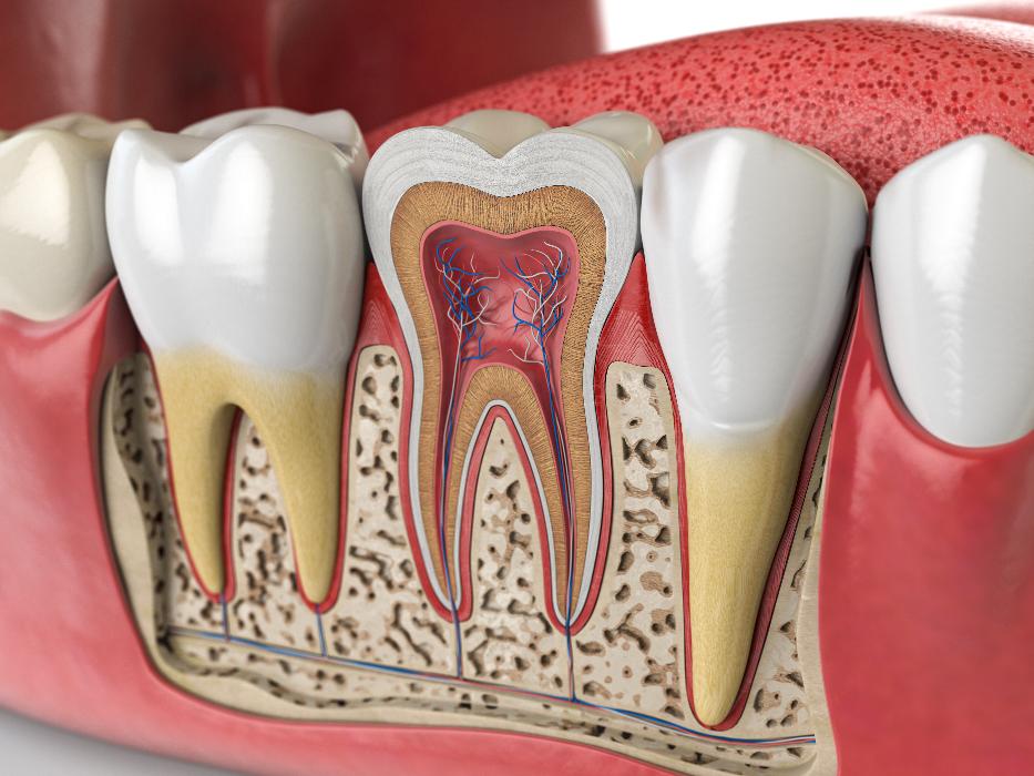 side view of infected tooth | root canal parramatta