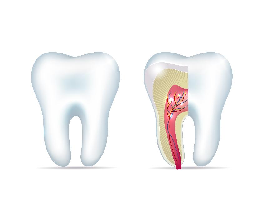 close up of infected tooth | root canal parramatta