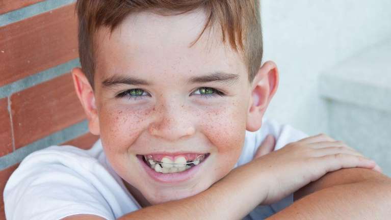 Boy with Braces | Pareamatta Dentist