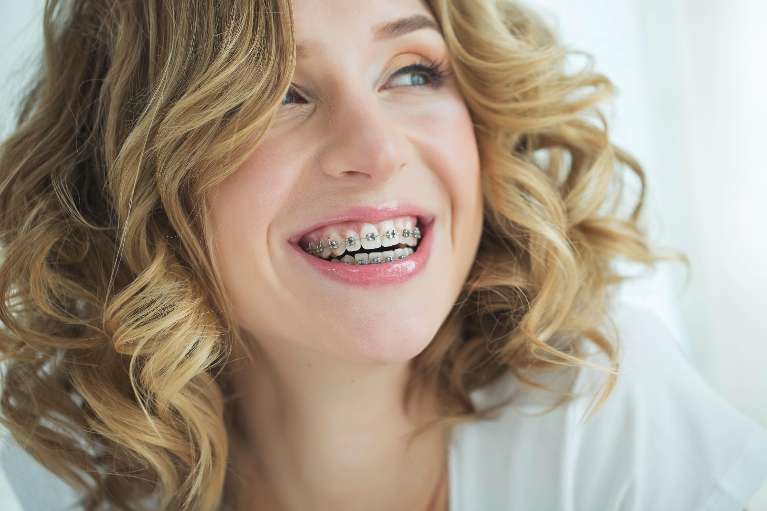 woman with traditional braces smiling | orthodontics harris park