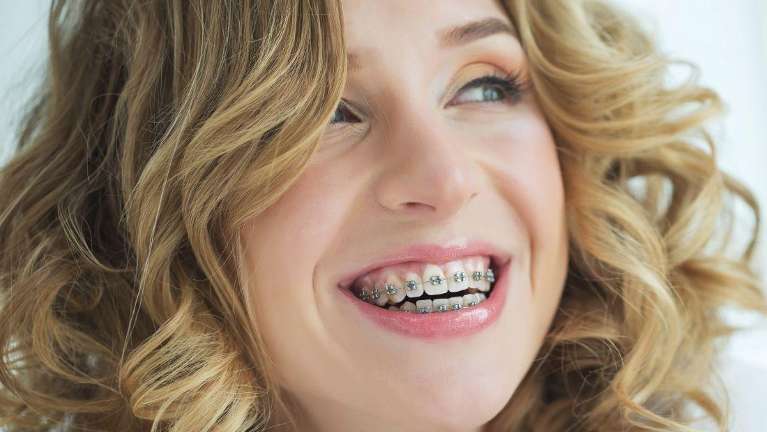 woman with curly hair smiling | orthodontics parramatta