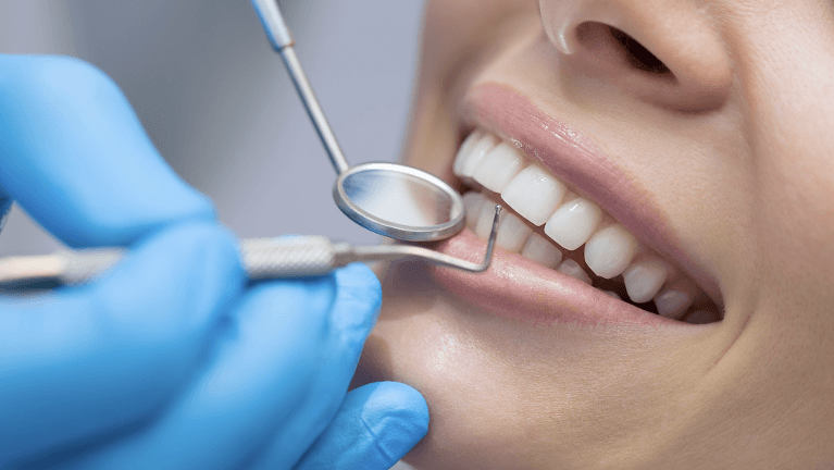 dental benefits Parramatta | Dental Cleans