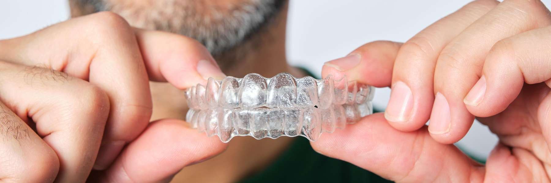an orthodontic patient holding Invisalign Express aligners