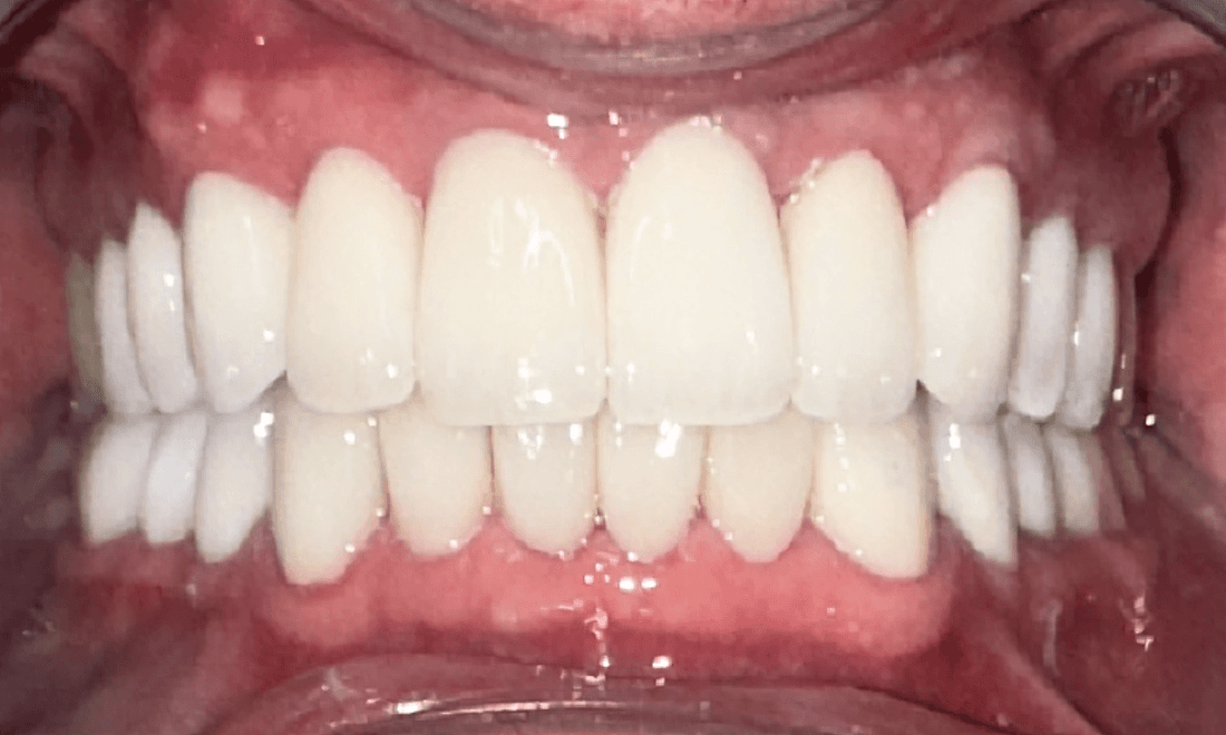 bright smile after dental work | dentist parramatta